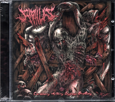 Syphilis - Coronary Artery bypass Grafting CD