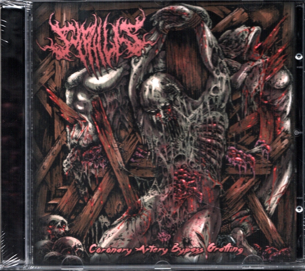 Syphilis - Coronary Artery bypass Grafting CD